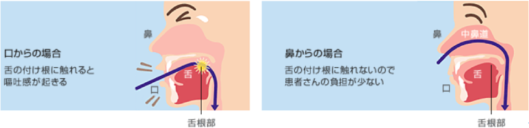 胃カメラ-経鼻・経口